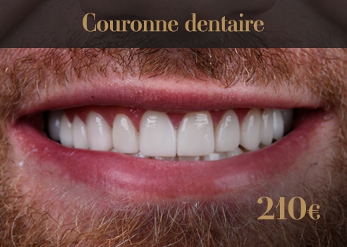 couronne dentaire
