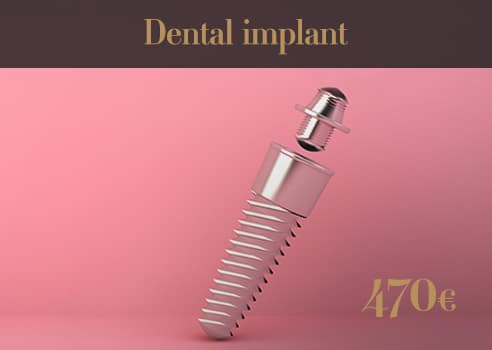 Implant Soins dentaires